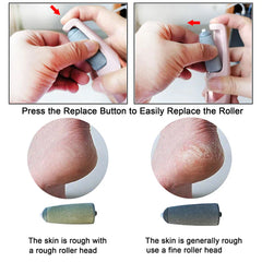 Electric Foot Callus Remover